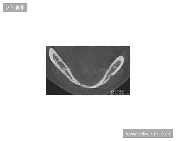 韦林顿确诊上唇部贯通伤；11、21牙半脱位；上颌前牙区牙槽骨骨折